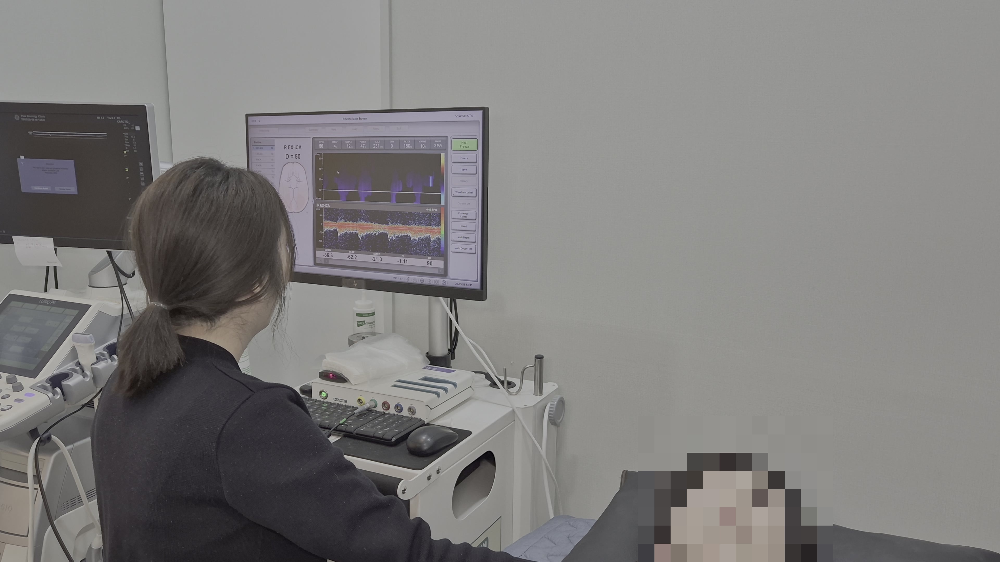 뇌혈류초음파 검사 사진 2