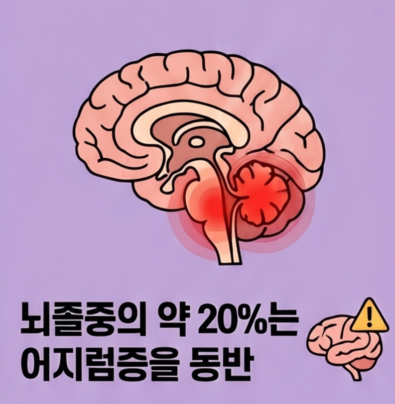 소뇌와 뇌간 문제로 생길 수 있는 어지럼증 뇌졸중 신호 안내 이미지