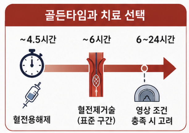 정맥 혈전용해제와 혈전제거술의 뇌졸중 골든타임 안내