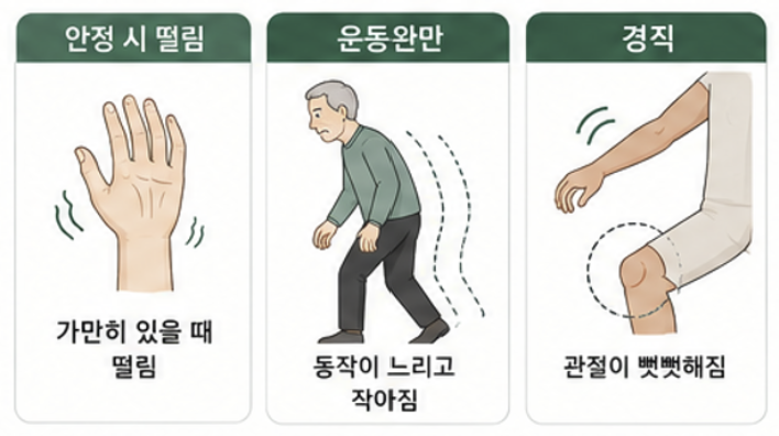 떨림·느린 동작·근육 경직 등 파킨슨병의 대표 운동증상