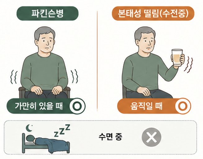 동작하거나 자세를 유지할 때 심해지는 본태성 떨림